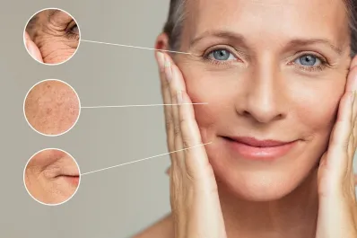 Adiós arrugas: buenos hábitos para combatir las marcas de envejecimiento