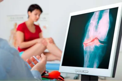 Artrosis prematura: cuáles son sus causas y qué grupo de personas pueden ser las más afectadas