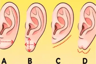 Test viral: la forma de tu oreja revelará los rasgos ocultos de tu personalidad