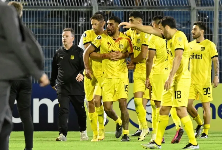 Un jugador de Peñarol debió ser internado por una agresión en Rosario