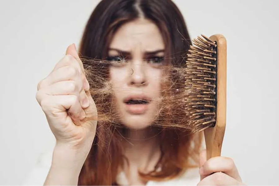 Caída de pelo. Los momentos en que esta normalidad es preocupante. 