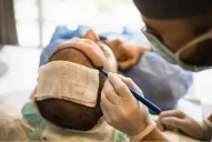 Caída del pelo: cuáles son los efectos secundarios más comunes de un trasplante capilar