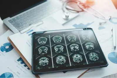 Parkinson: este es el síntoma silencioso que puede aparecer 20 años antes del diagnóstico