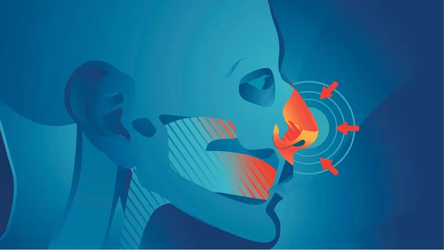 El Parkinson es una patología neurodegenerativa crónica y progresiva que afecta que afecta al movimiento 