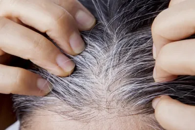 Qué comer para prevenir las canas: guía de alimentos recomendados