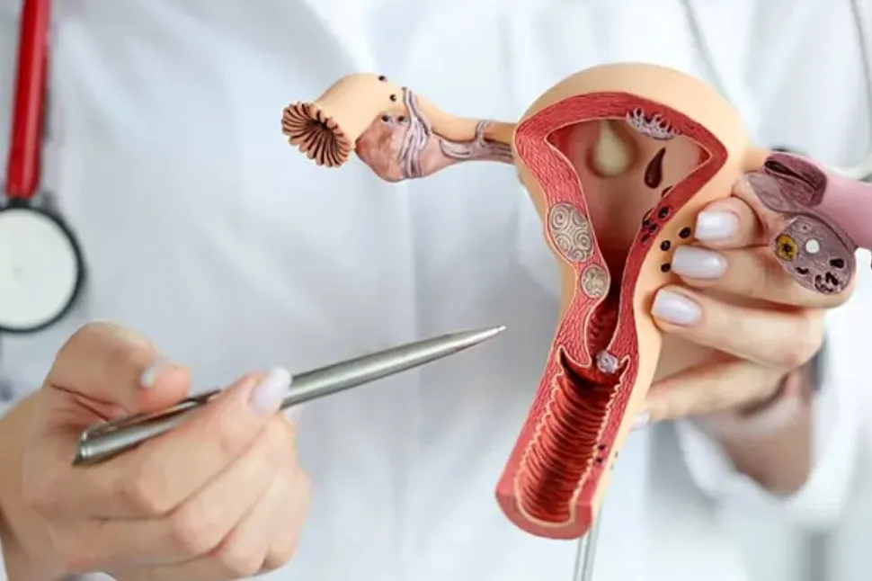 Cáncer de cuello uterino: cuáles son los síntomas para ir urgente al médico