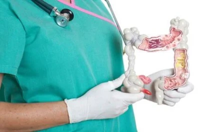 En Argentina, se diagnostican casi dos nuevos casos de cáncer colorrectal por hora