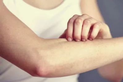 ¿Picazón en la piel? Podría ser una señal temprana de cáncer de páncreas