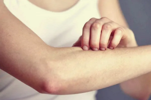 ¿Picazón en la piel? Podría ser una señal temprana de cáncer de páncreas
