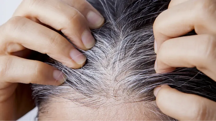 A medida que pasan los años, aparecen las canas en el pelo