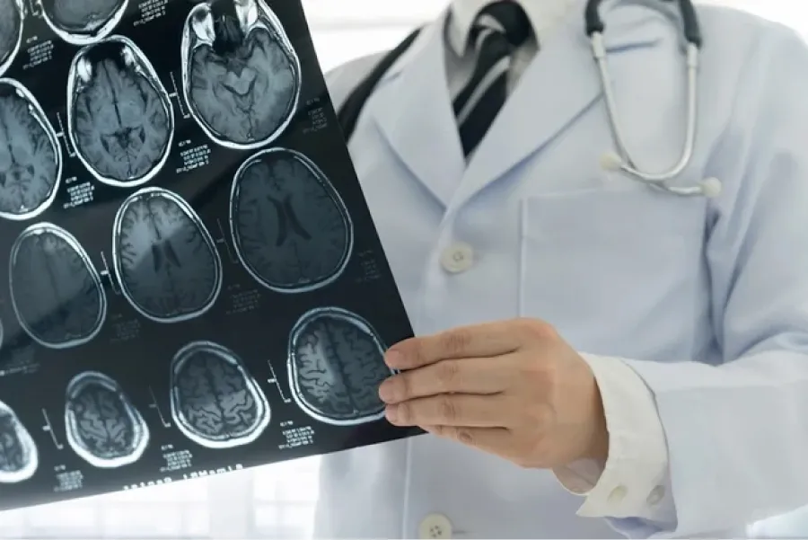 ¿Cuándo es preciso acudir a un neurólogo?