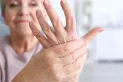 Artritis y frío: por qué duelen más las articulaciones en personas mayores