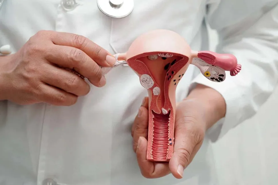 Seis señales de endometriosis y que confundes con dolor menstrual