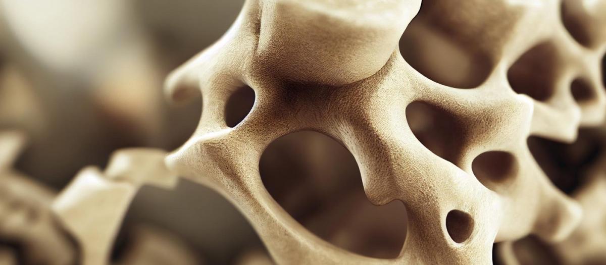 ¿Cómo prevenir la osteoporosis?