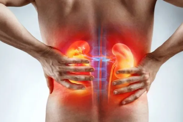 Cáncer silencioso: ¿por qué lo llaman así y cuáles son sus síntomas?