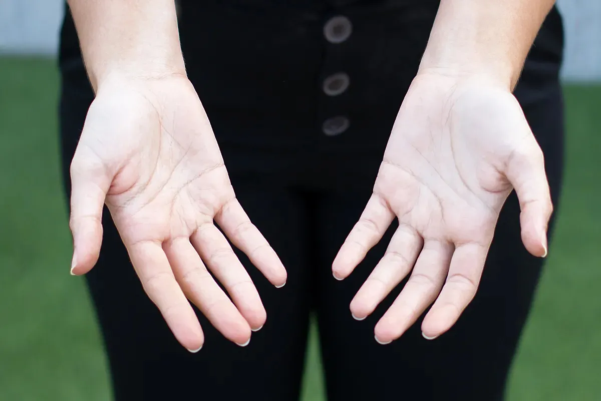Dolor de manos: por qué deberías consultar con un médico