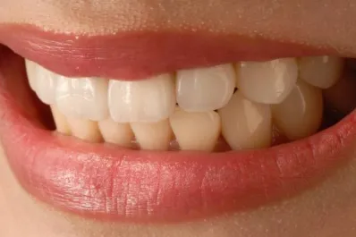 Estos alimentos debes evitar para no manchar los dientes