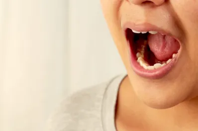 Dolor, llagas y otros síntomas del cáncer de boca: causas que lo pueden desencadenar