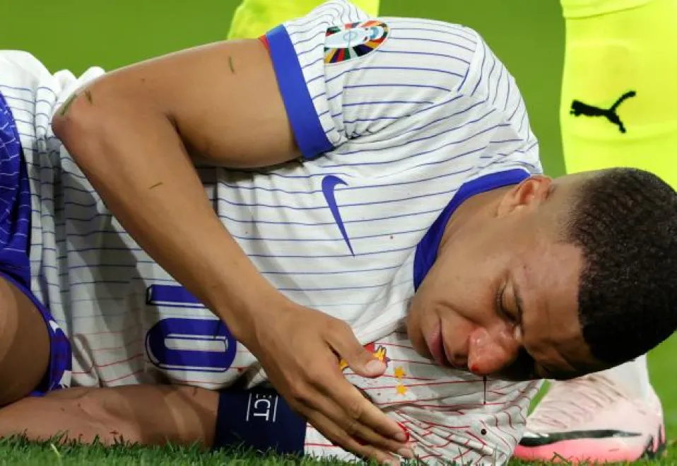 Kylian Mbappé se fracturó la nariz en el debut de Francia; ¿se queda afuera de la Eurocopa?