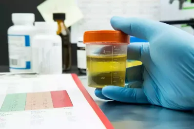 Color de la orina: ¿qué significa cada tono y cuándo consultar al médico?