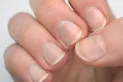 Si aparece esta marca en tus uñas deberías consultar al médico