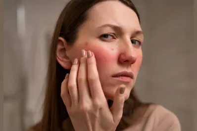 Edema facial: por qué nos despertamos con la cara hinchada y cómo solucionarlo
