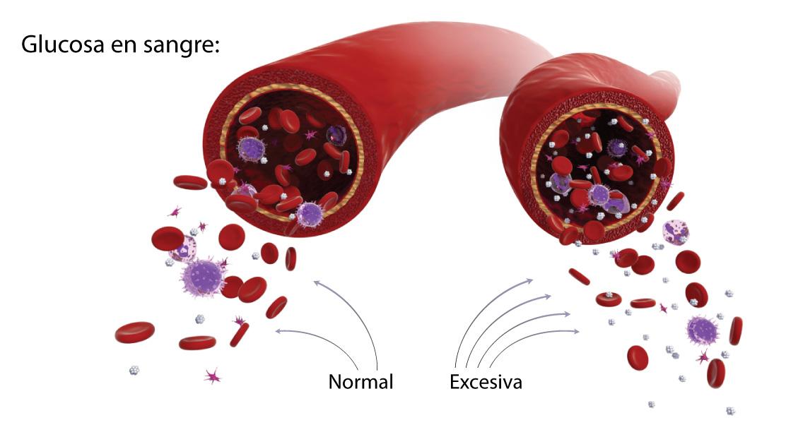 ¿Cómo se acumula la glucosa?