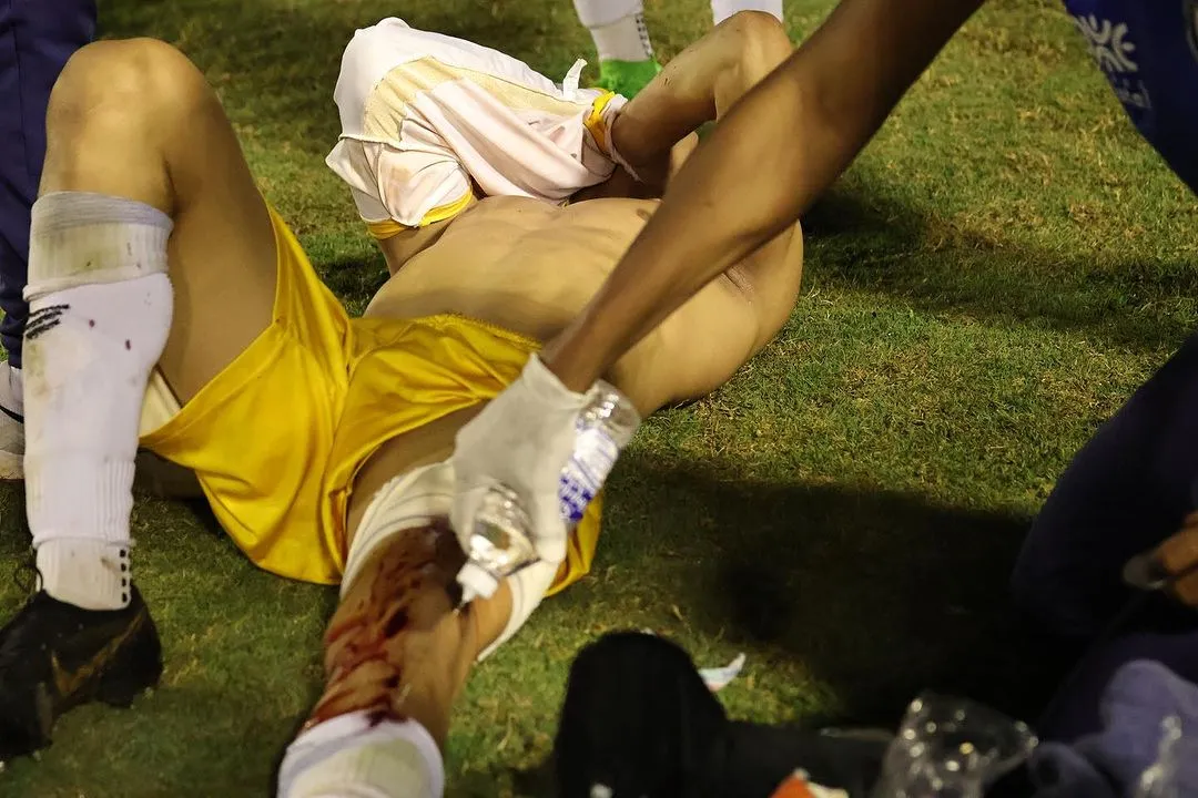 Escándalo en el fútbol brasileño: le dispararon en pleno campo de juego