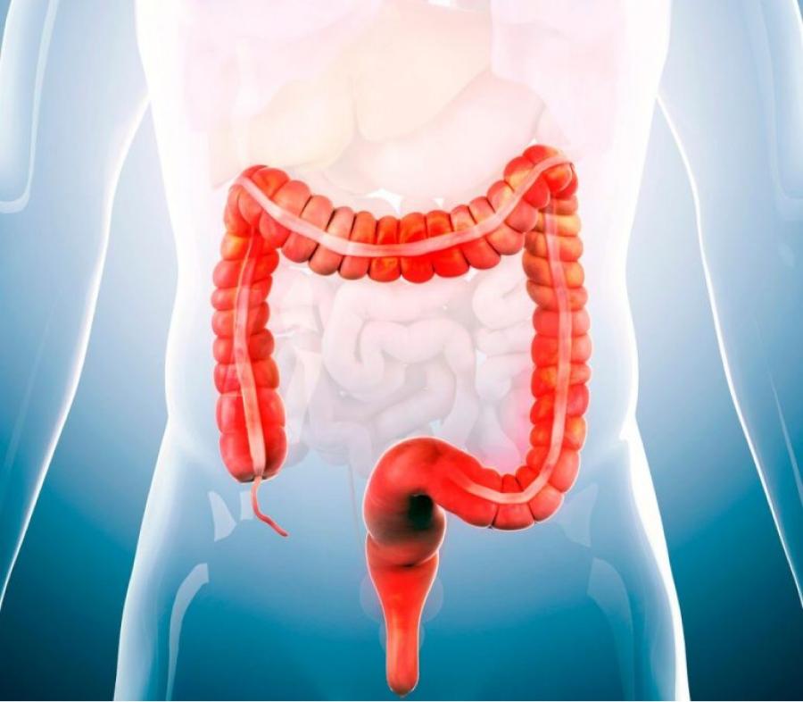 ¿Qué sucede cuando padecemos de colon irritable?