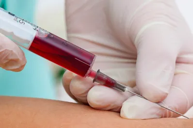 Cuál es el alimento ideal para controlar el azúcar en sangre de forma natural