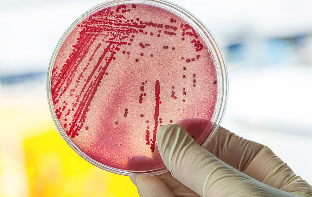 Escherichia Coli, una d elas nefermedades que pueden trasmitir las botellas.