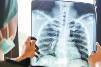 Contaminación del aire: el nuevo factor de riesgo para el cáncer de pulmón en no fumadores