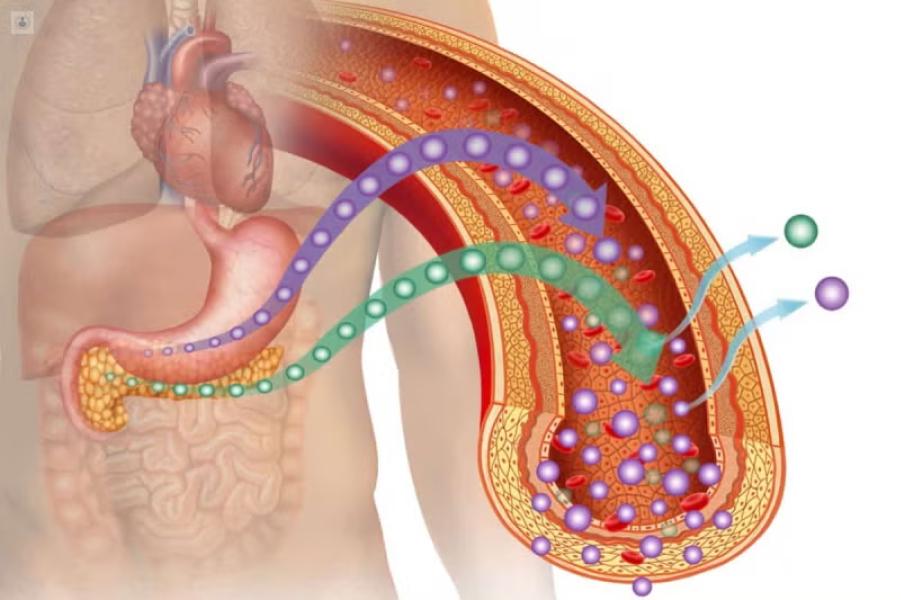 Con la diabetes, el páncreas no puede producir la suficiente insulina.