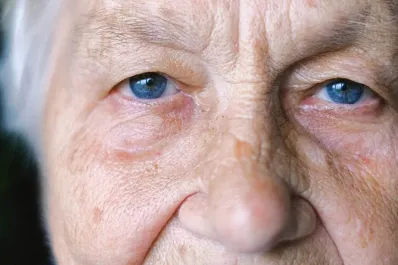 Las señales en la vista que pueden prevenir la demencia hasta 12 años antes