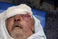 Un hombre de 67 años fue golpeado de manera salvaje por un ladrón que entró a su casa, en Villa Carmela