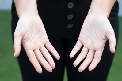 Diez señales de enfermedades que nuestros dedos pueden avisarnos y no lo sabemos