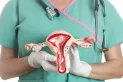 Este es el síntoma más habitual para detectar el cáncer de cuello uterino
