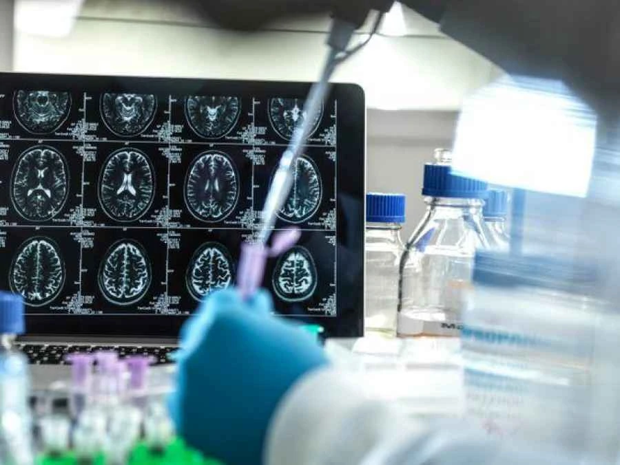 Urge tener un plan ante el aumento de casos de Alzheimer