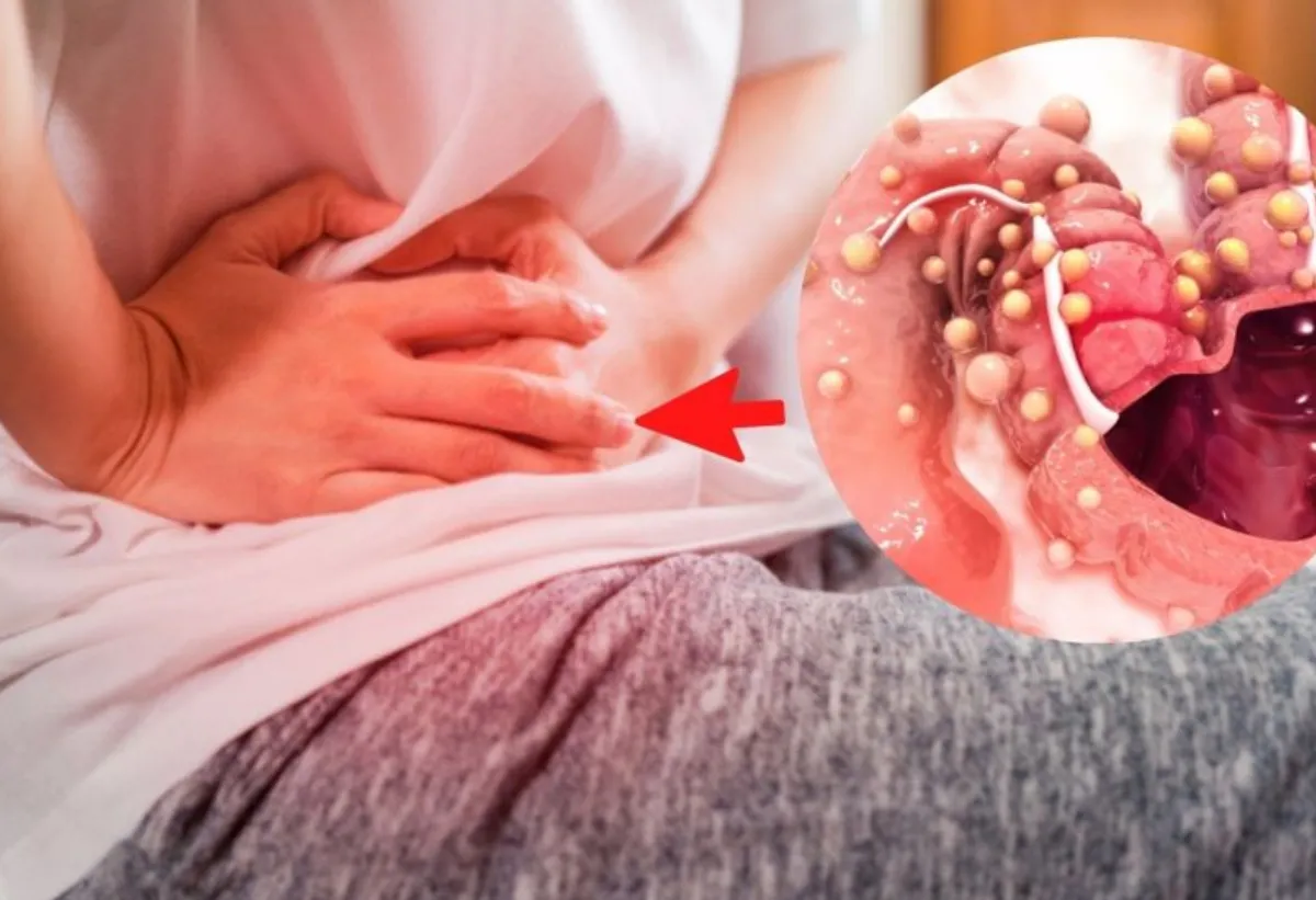  ¿Qué alimento aumenta el riesgo de cáncer de colon?