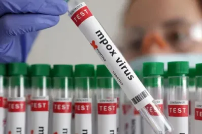 Rosario de Santa Fe: confirman el segundo caso de viruela del mono