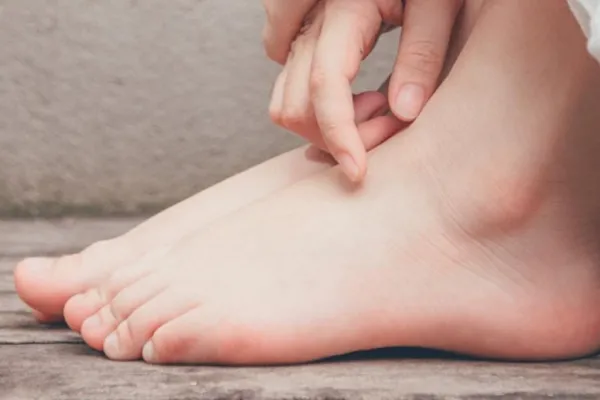 ¿Cómo identificar el pie plano en tus hijos y evitar problemas a largo plazo?