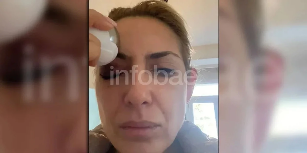 Fabiola Yáñez presentó nuevas imágenes de golpes 