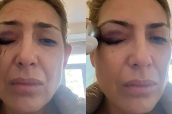 Fabiola Yáñez presentará pruebas de que el ex médico presidencial la atendió por golpes