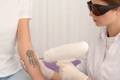 La Generación Z se arrepiente de sus tatuajes e impulsa la industria del borrado