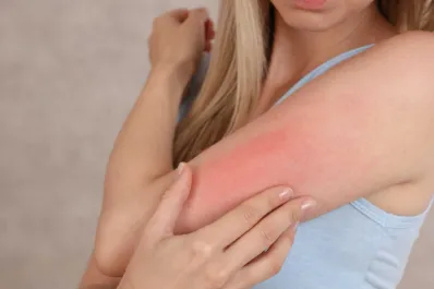 La manera en que la piel influye en nuestra salud y expectativa de vida, según una investigación