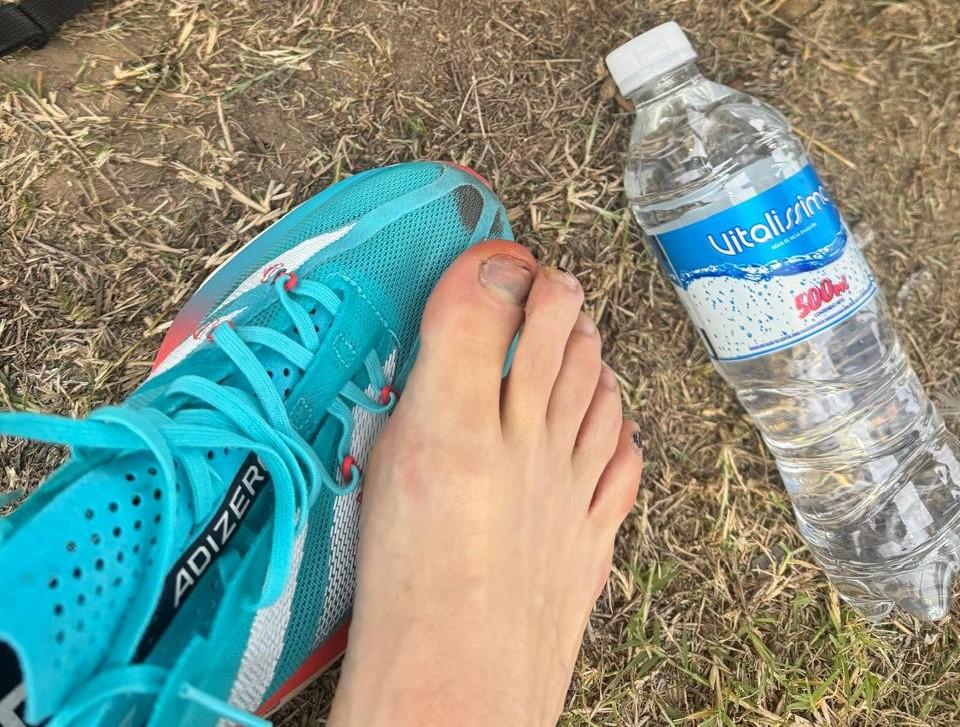 Media Maratón de Buenos Aires: la historia de la tucumana que llegó a la meta con los pies sangrando