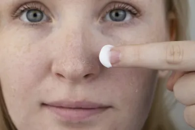 La vitamina que no puede faltar en tu crema para combatir las manchas en la piel