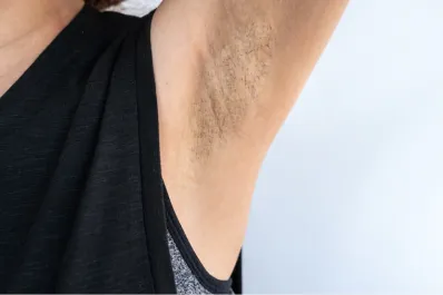 Cuáles son los riesgos de tener manchas en las axilas y el cuello