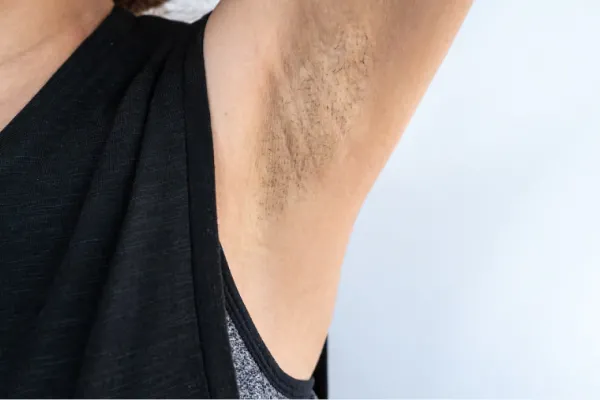 Cuáles son los riesgos de tener manchas en las axilas y el cuello