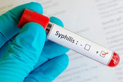 Pico histórico de sífilis en Argentina: cómo reconocer los síntomas en las tres etapas de la enfermedad